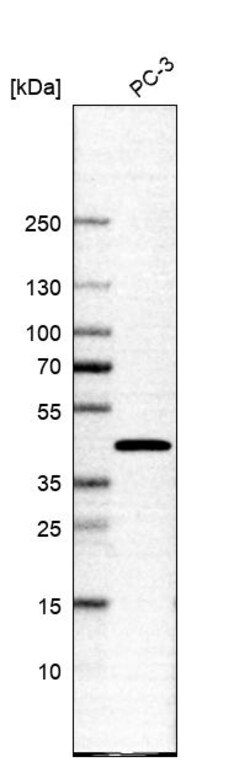 Invitrogen SLC35E1 Polyclonal Antibody 100 &mu;L; Unconjugated:Antibodies,