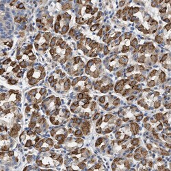 Invitrogen TMEM222 Polyclonal Antibody 100 &mu;L | Buy Online | Invitrogen&trade; | Fisher Scientific