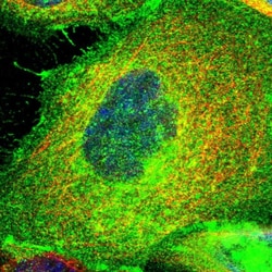 Invitrogen PGAP3 Polyclonal Antibody 100 &mu;L; Unconjugated:Antibodies,
