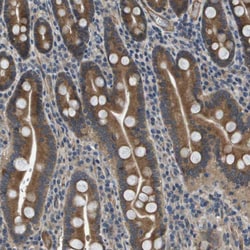 Invitrogen PGAP3 Polyclonal Antibody 100 &mu;L; Unconjugated:Antibodies,