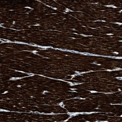 Invitrogen LMBR1 Polyclonal Antibody 100 &mu;L; Unconjugated:Antibodies,