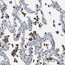 Invitrogen SLC19A2 Polyclonal Antibody 100 &mu;L; Unconjugated:Antibodies,