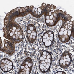 Invitrogen ASC1 Polyclonal Antibody 100 &mu;L; Unconjugated:Antibodies,