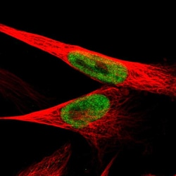 Invitrogen JMJD1B Polyclonal Antibody 100 &mu;L; Unconjugated:Antibodies,