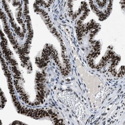 Invitrogen JMJD1B Polyclonal Antibody 100 &mu;L; Unconjugated:Antibodies,