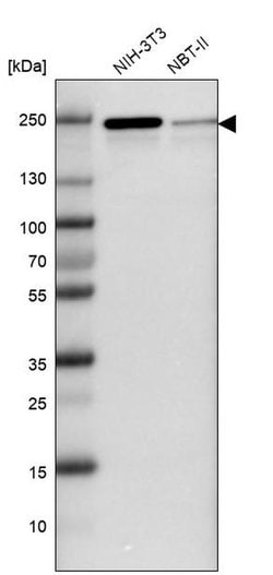 Invitrogen JMJD1B Polyclonal Antibody 100 &mu;L; Unconjugated:Antibodies,