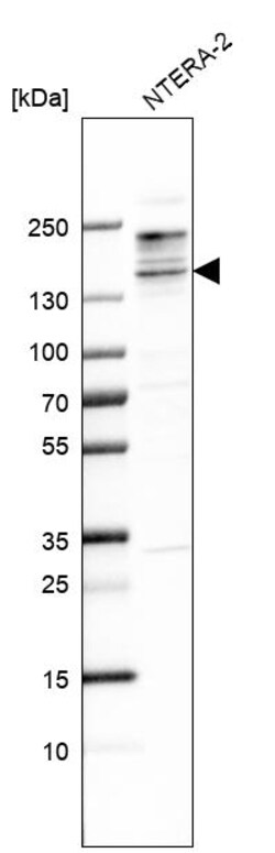 Invitrogen&trade;&nbsp;SALL3 Polyclonal Antibody