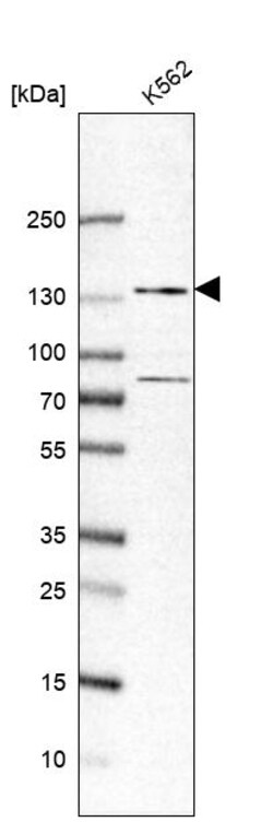 Invitrogen ZFR Polyclonal Antibody 100 &mu;L | Buy Online | Invitrogen&trade; | Fisher Scientific