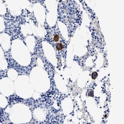 Invitrogen TREML1 Polyclonal Antibody 100 &mu;L; Unconjugated:Antibodies,