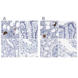Invitrogen TREML1 Polyclonal Antibody 100 &mu;L; Unconjugated:Antibodies,