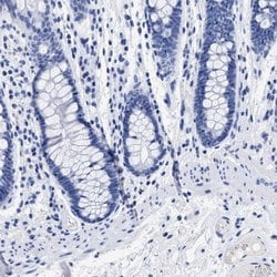 Invitrogen TREML1 Polyclonal Antibody 100 &mu;L; Unconjugated:Antibodies,