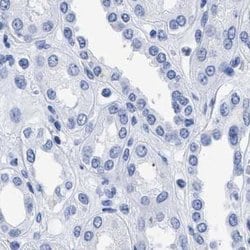 Invitrogen TREML1 Polyclonal Antibody 100 &mu;L; Unconjugated:Antibodies,