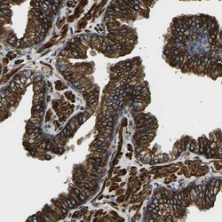Invitrogen Kir4.2 (KCNJ15) Polyclonal Antibody 100 &mu;L | Buy Online | Invitrogen&trade; | Fisher Scientific