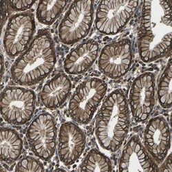 Invitrogen Kir4.2 (KCNJ15) Polyclonal Antibody 100 &mu;L | Buy Online | Invitrogen&trade; | Fisher Scientific