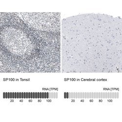Invitrogen SP100 Polyclonal Antibody 100 &mu;L; Unconjugated:Antibodies,