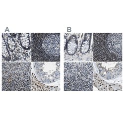 Invitrogen SP100 Polyclonal Antibody 100 &mu;L; Unconjugated:Antibodies,