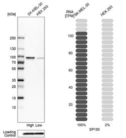 Invitrogen SP100 Polyclonal Antibody 100 &mu;L; Unconjugated:Antibodies,