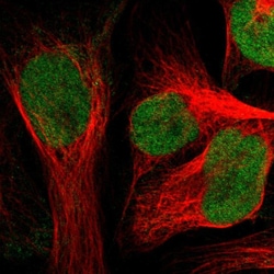 ZNF22 Polyclonal Antibody:Antibodies, Polyclonal