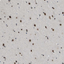 Invitrogen SMARCAD1 Polyclonal Antibody 100 &mu;L; Unconjugated:Antibodies,