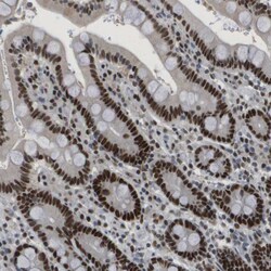 Invitrogen SMARCAD1 Polyclonal Antibody 100 &mu;L; Unconjugated:Antibodies,