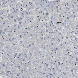 Invitrogen SMARCAD1 Polyclonal Antibody 100 &mu;L; Unconjugated:Antibodies,