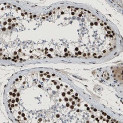 Invitrogen SMARCAD1 Polyclonal Antibody 100 &mu;L; Unconjugated:Antibodies,