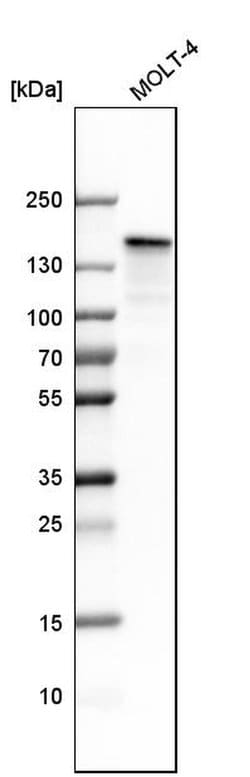 Invitrogen SMARCAD1 Polyclonal Antibody 100 &mu;L; Unconjugated:Antibodies,