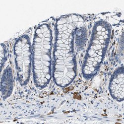 Invitrogen MAPRE2 Polyclonal Antibody 100 &mu;L; Unconjugated:Antibodies,