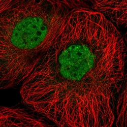 Invitrogen PTPDC1 Polyclonal Antibody 100 &mu;L; Unconjugated:Antibodies,