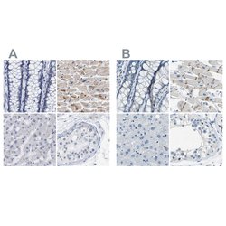 Invitrogen XIRP1 Polyclonal Antibody 100 &mu;L; Unconjugated:Anticuerpos