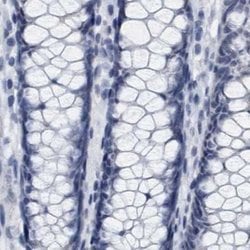 Invitrogen XIRP1 Polyclonal Antibody 100 &mu;L; Unconjugated:Anticuerpos