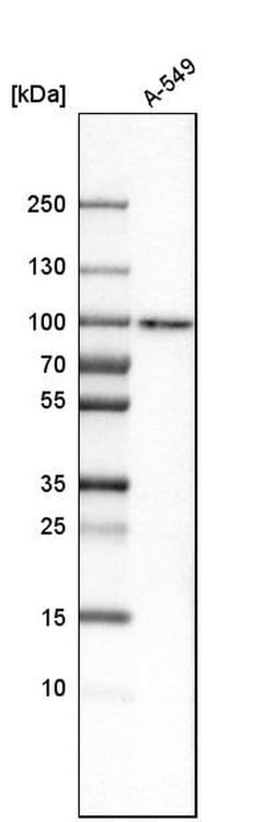 Invitrogen SAMD4B Polyclonal Antibody 100 &mu;L; Unconjugated:Antibodies,