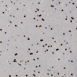 Invitrogen ZBTB20 Polyclonal Antibody 100 &mu;L; Unconjugated:Antibodies,