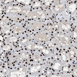 Invitrogen ZBTB20 Polyclonal Antibody 100 &mu;L; Unconjugated:Antibodies,