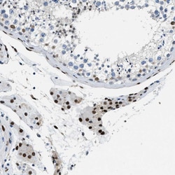 Invitrogen ZBTB20 Polyclonal Antibody 100 &mu;L; Unconjugated:Antibodies,