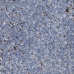 Invitrogen ZBTB20 Polyclonal Antibody 100 &mu;L; Unconjugated:Antibodies,