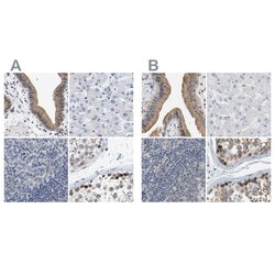Invitrogen Pericentrin Polyclonal Antibody 100 &mu;L; Unconjugated:Antibodies,