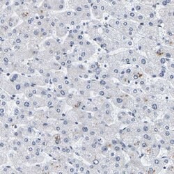 Invitrogen Pericentrin Polyclonal Antibody 100 &mu;L; Unconjugated:Antibodies,