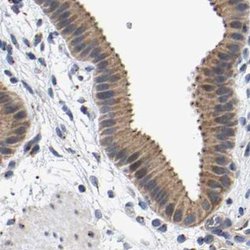 Invitrogen Pericentrin Polyclonal Antibody 100 &mu;L; Unconjugated:Antibodies,