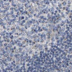 Invitrogen Pericentrin Polyclonal Antibody 100 &mu;L; Unconjugated:Antibodies,