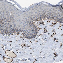 Invitrogen ZNF831 Polyclonal Antibody 100 &mu;L; Unconjugated:Antibodies,