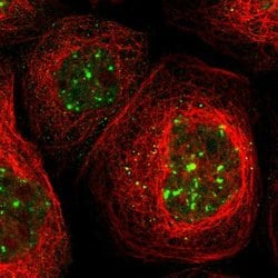 Invitrogen PTPN23 Polyclonal Antibody 100 &mu;L; Unconjugated:Antibodies,