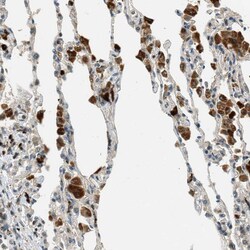 Invitrogen PTPN23 Polyclonal Antibody 100 &mu;L; Unconjugated:Antibodies,