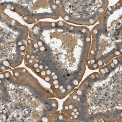 Invitrogen PTPN23 Polyclonal Antibody 100 &mu;L; Unconjugated:Antibodies,