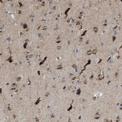 Invitrogen PTDSS1 Polyclonal Antibody 100 &mu;L; Unconjugated:Antibodies,