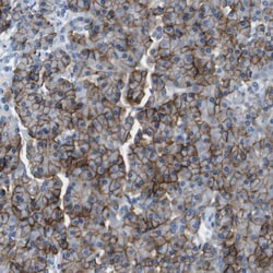 Invitrogen SLC16A10 Polyclonal Antibody 100 &mu;L; Unconjugated:Antibodies,