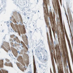 Invitrogen SLC16A10 Polyclonal Antibody 100 &mu;L; Unconjugated:Antibodies,