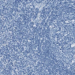 Invitrogen SLC16A10 Polyclonal Antibody 100 &mu;L; Unconjugated:Antibodies,