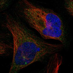 Invitrogen CTIF Polyclonal Antibody 100 &mu;L; Unconjugated:Antibodies,