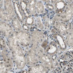 Invitrogen CTIF Polyclonal Antibody 100 &mu;L; Unconjugated:Antibodies,